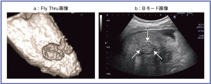 }8@̑ւFly Thrủpî񎡗Õj