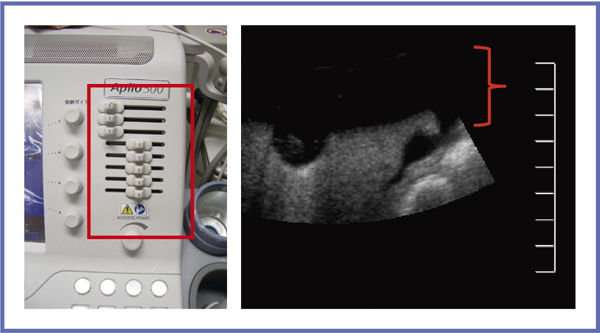 }9@STC郌x܂Ń[ɂĉz쐬