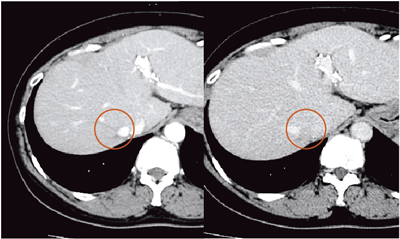 }12@Ǘ1F51΁CCB^C̉`̍dρCS7C11mmCHCCieCTj