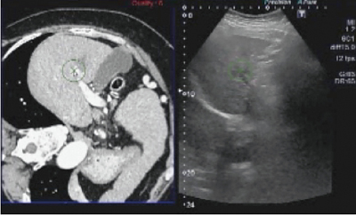 }15@Ǘ2F71΁CCBC^C̍dρCS5CHCCCRFAÕ͂̍Ĕ