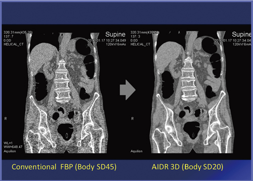 }2@AIDR 3D̗LɂmCY̍ 