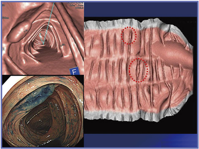 }4@Aquilion CXL̃R\[WSł̉摜] ̏ɕaρijF߂B