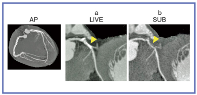 }2@Ǘ1F70ΑCCxΊDǗ aFCPRCbFTugNV摜iW.I.P.j