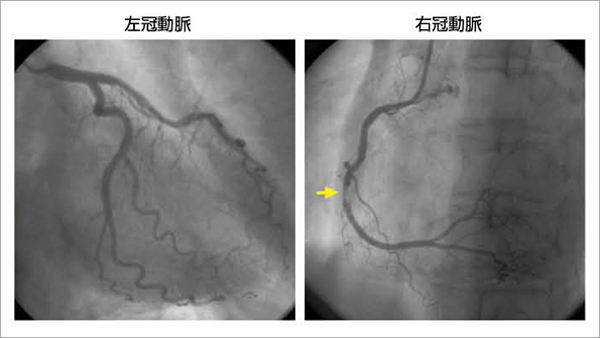 }3  63΁CjCJ쐫Sǁ@Eseg 2F75%Ǘ