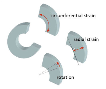 図3　短軸画像で定義されている壁運動パラメータ