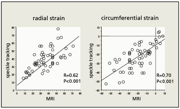 図7　2DTとMRIタギングとの相関