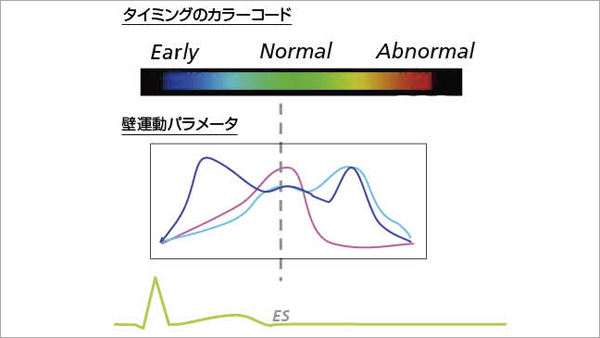 図9　タイミングのカラーコード化