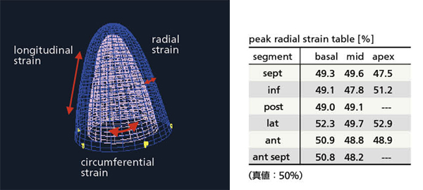 図12　三次元画像中のストレイン