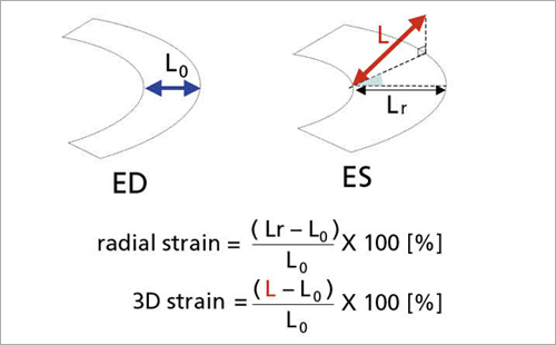 図13　三次元画像中の壁運動パラメータ