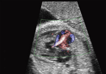 }8@E[ƎOٕsSCDP19T