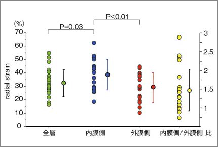 図2 健常例の中部前壁中隔のradial strain