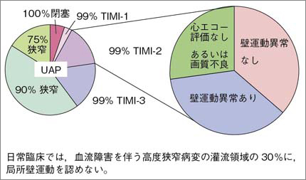 図3 不安定狭心症例の責任冠動脈狭窄率と99%狭窄病変に造影遅延を伴う群における心エコー壁運動評価