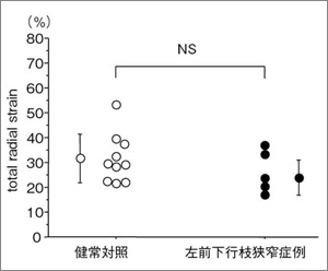 }7@OǒȗSwradial strain