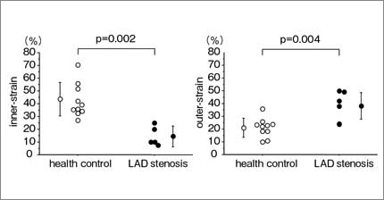 }8@Oǒu̓radial strainijCOradial strainiEj