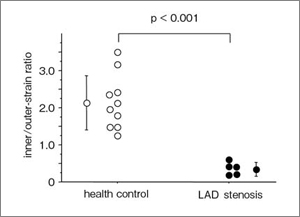 図9 前壁中隔の内膜側/外膜側radial strain 比