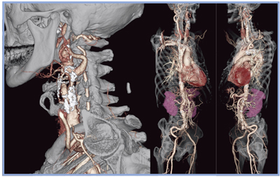 }1@ԑтɍsꂽVR摜i򓮖Ǘj