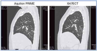 }3@xTvOɂ掿̔rix̃TW^摜j