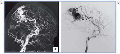 }5@OTugNV摜iajƌǑeibjƂ̔r