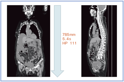 }6@EgwJXLiAIDR 3DFMildj