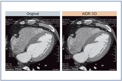 }7@52΁CjCS؍[ǂ̏Ǘ摜 AIDR 3DɂmCY̒ጸ