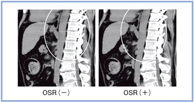 }7@OSRɂA[`t@Ng̉PiAIDR 3D Weakj