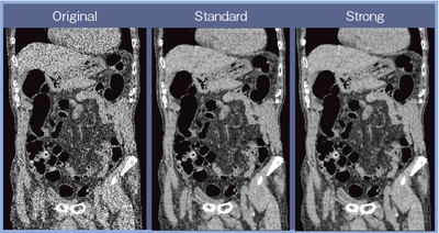 }5@AIDR 3D̗Lɂ摜̔riCTDIvolF1.9mGyj