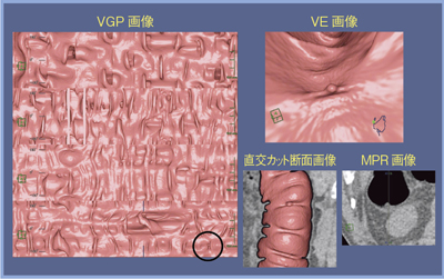 }6@}5ƓǗCTC摜iCTDIvolF1.9mGyj