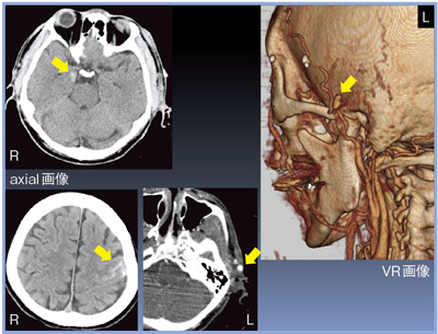 }1@Ǘ1F1mmXCX̍č\摜 󑤓̑ 