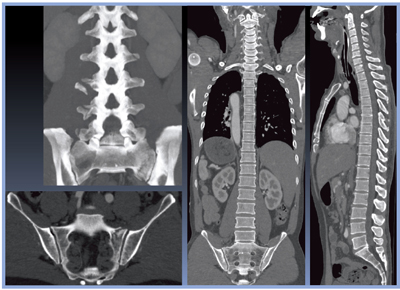 }3@Ǘ1FSgCT摜iAIDR 3D Mildj