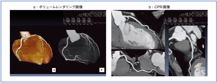 }3@Sd}tbVXLɂ鐳튥CT摜