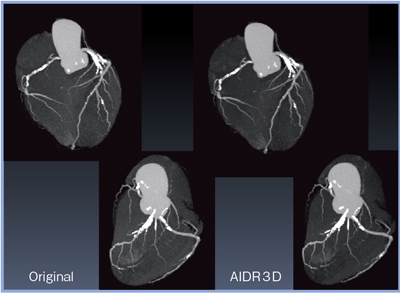 }4@AIDR 3D̗LɂriMIP摜j