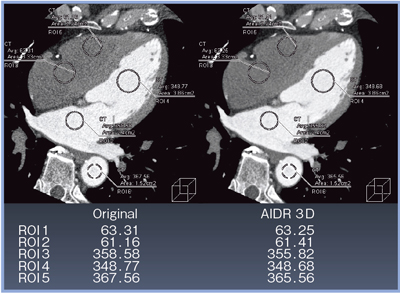 }5@AIDR 3D̗LɂCNR̔riMPR摜j