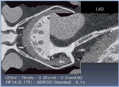 }8@AIDR 3Dɂ掿ʁi\֐{AIDR 3Dj XegċEΊD̏Ǘ