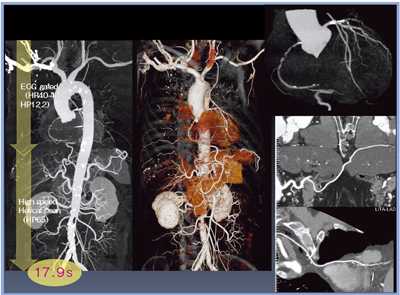 }10@VHPpCABGp̊Ƒ哮̓]