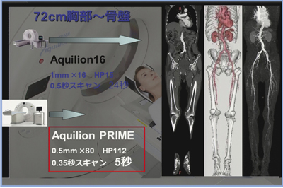}5@Aquilion16Aquilion PRIME̎BeԂ̔r