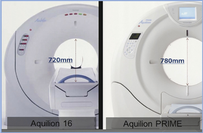 }6@Aquilion16Aquilion PRIMẼKg[Ja̔r