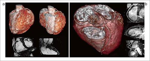 }1@Atlas SPEEDERɂ鎩RċzWH MRCA摜i3jiajƑ~WH MRCA摜i34bjibj