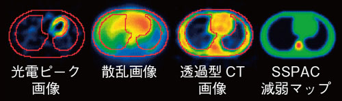 }1@SSPAC@Ɠߌ^CTɂ錸W}bv̌`r