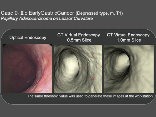 }1@BeXCẌႢɂaϕ`o\̕ω