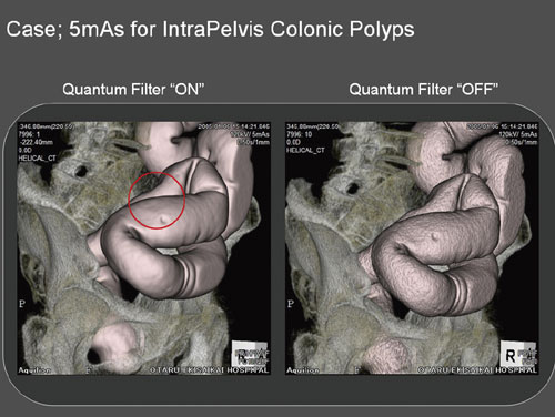 }2@ʎBei5mAsjł̗ʎqtB^̉p
