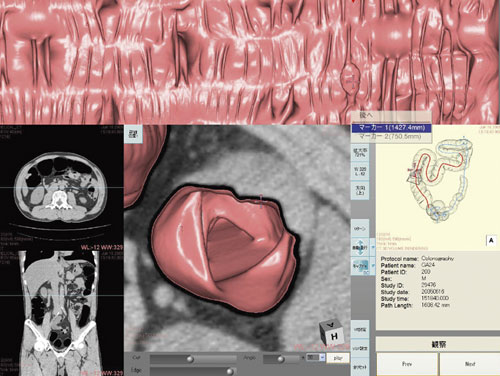 }5@VGP摜3D MPRF2^is