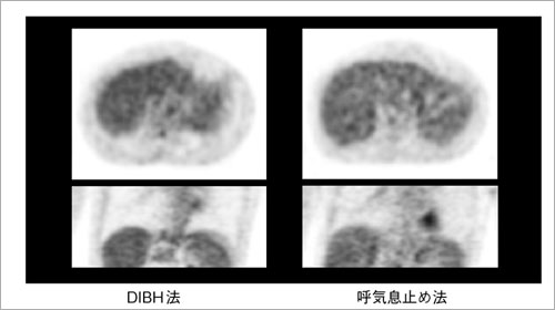 }3@DIBH@ƌċC~ߖ@̔r