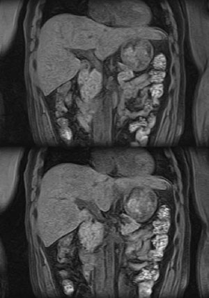 }3@Enhanced Fat FreeɂŜ̎b}f