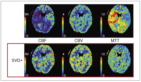 }1@tracer delaỷe󂯂ASYSVD+̌ʔr