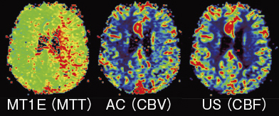}3@J[}bv\ileft MCÄ斝][ǁj