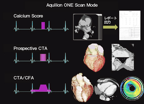 }4@Aquilion ONEɂBe[h