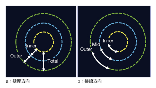 }1@Transmural Tracking̈ʒu`