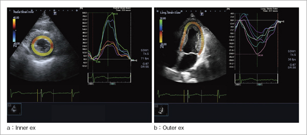 }2@Transmural Tracking̃pgbNC[WO