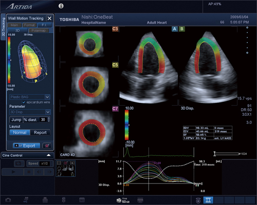 }5@One-Beat 3D WMT̉͗ij