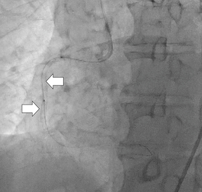}2@iDriverXegF3mm~18mm3mm~30mmj